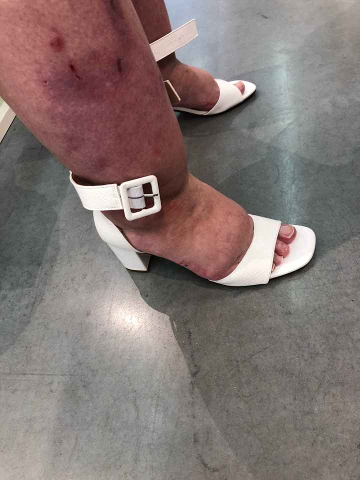 Chaussure Mariée - 1