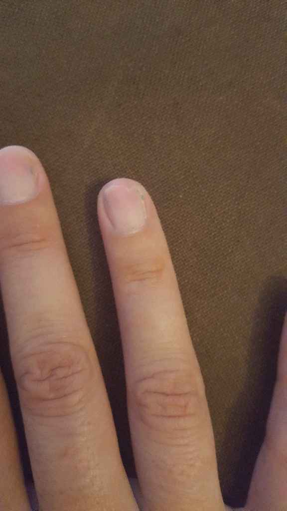 Manucure : Comment sont vos ongles ? - 1