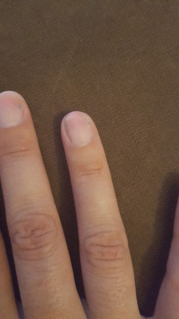 Manucure : Comment sont vos ongles ? - 1