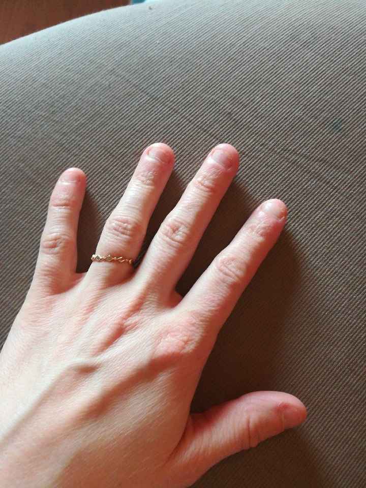 Faux ongles? - 1