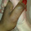 Noll