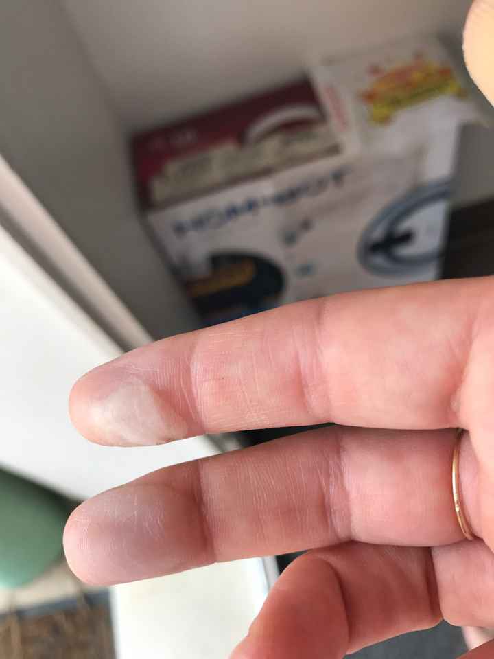 Mes mains! - 1