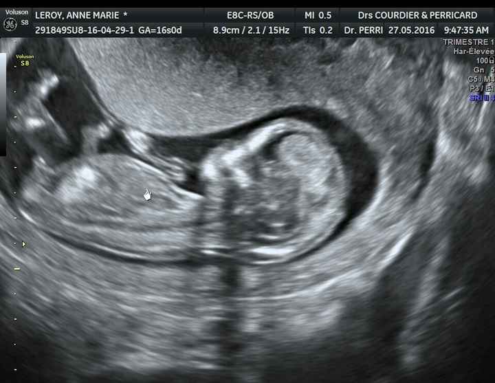 1er bébé 1ère grossesse panique - 1