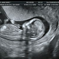 1er bébé 1ère grossesse panique - 1