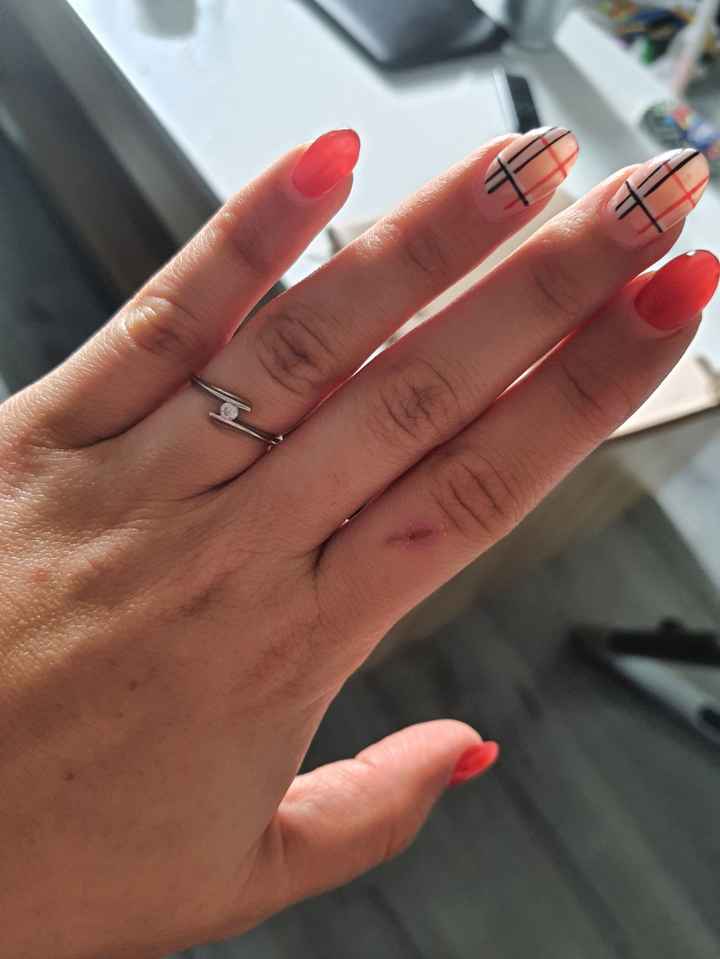 Montre-nous ta bague de fiançailles ! 💍 - 1