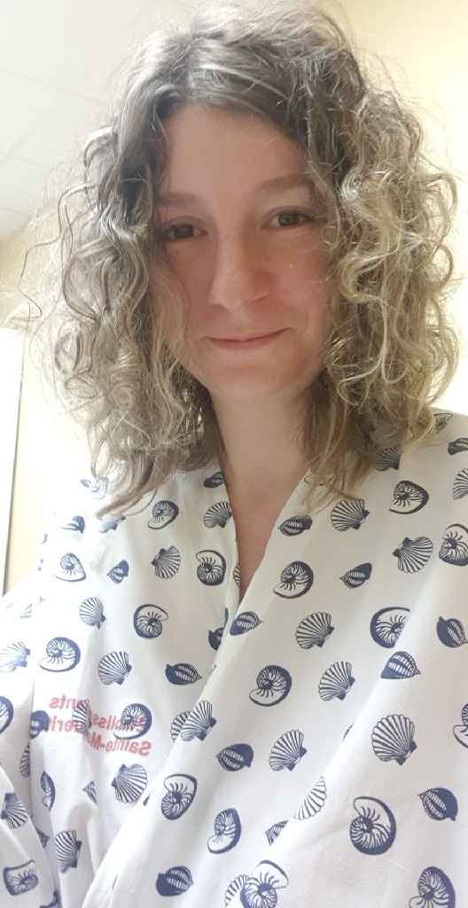 La cata sourcil apres operation - 1