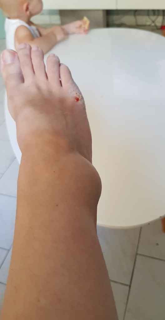 La semaine de la poisse continue - 1