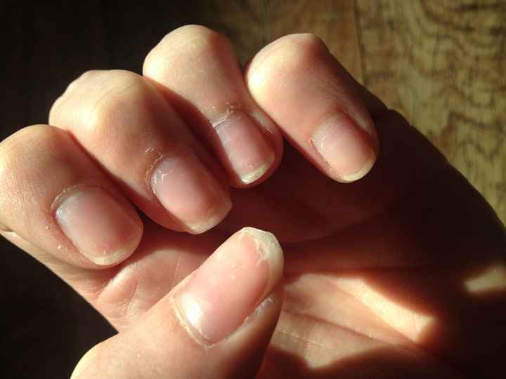 Attention au manucure gel - 1