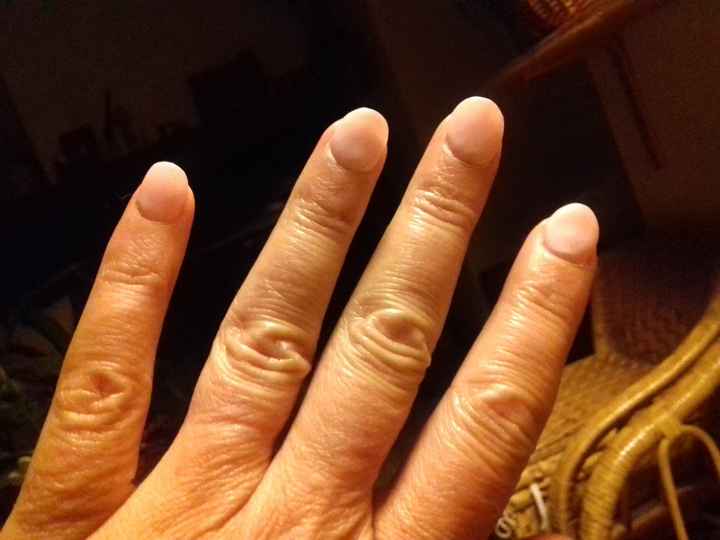 Mes petites saucisses toutes ridées...