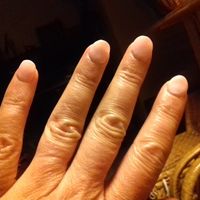 Mes petites saucisses toutes ridées...