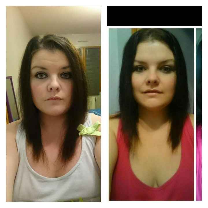 Pousse des cheveux - 1