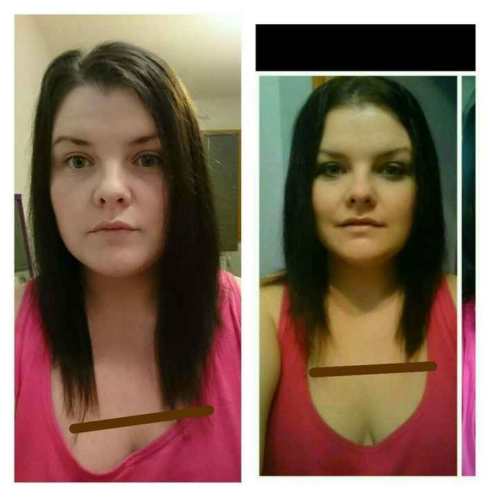 Pousse des cheveux - 1