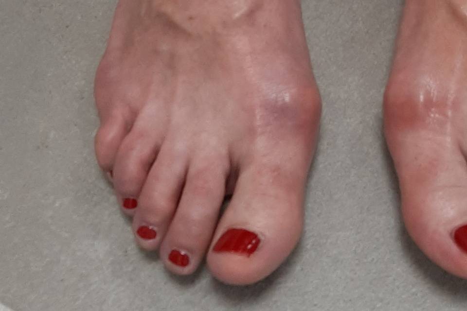 Beauté des pieds + pose vernis