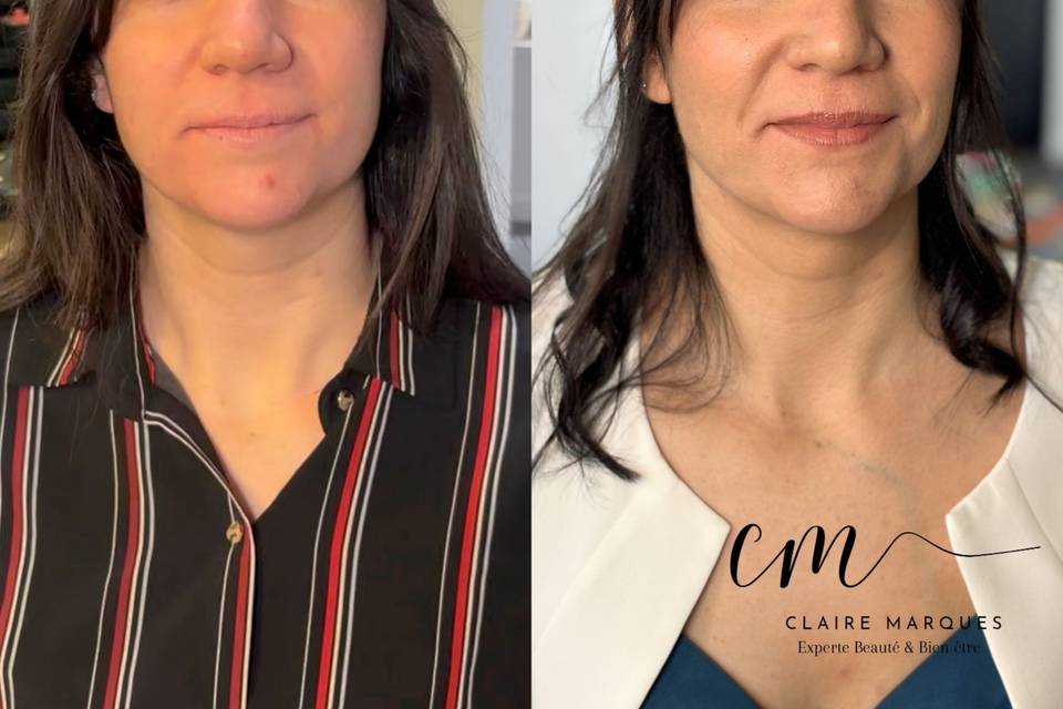 CM