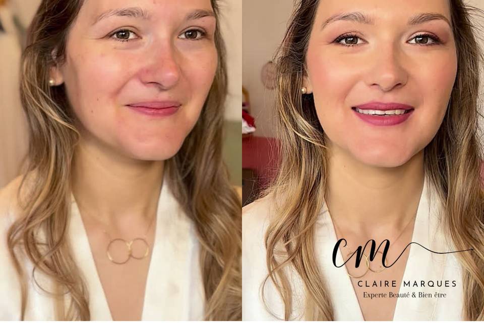 CM