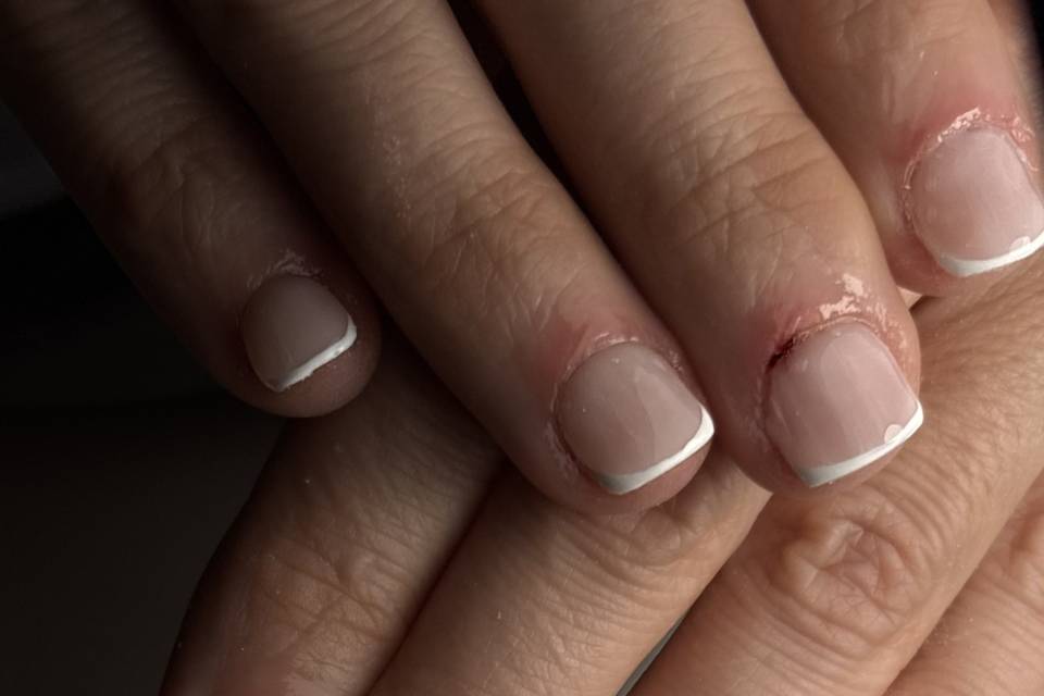 Ongle rongé