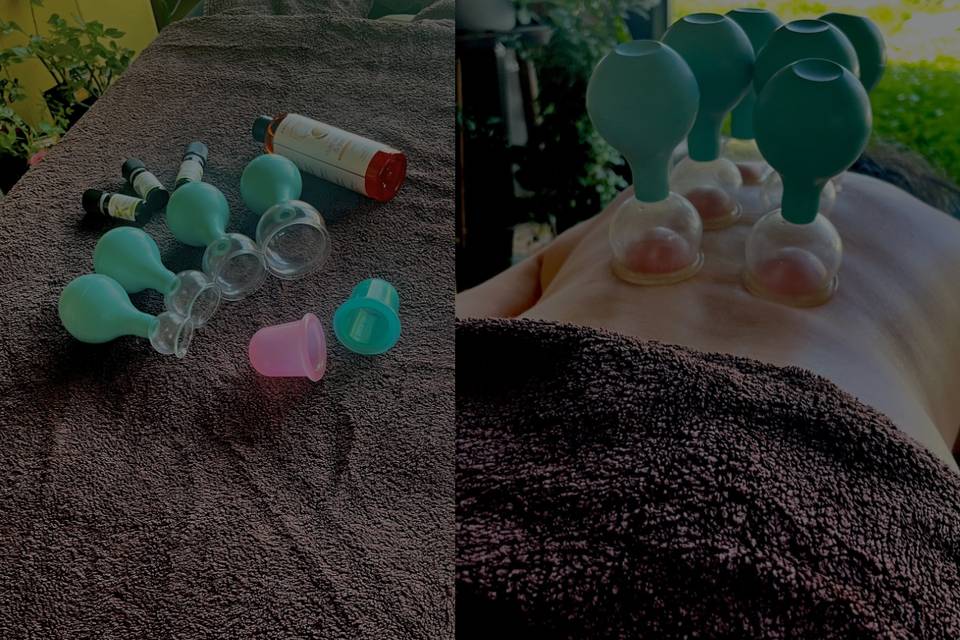 Cupping massage
