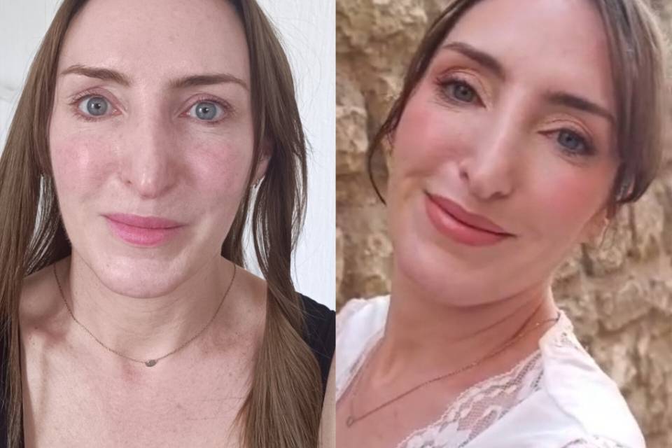 Emilie avant après