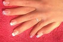 Ongles