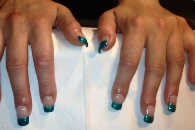 Ongles
