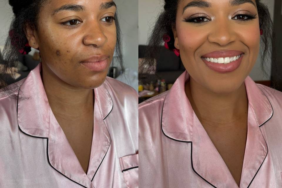 B&A