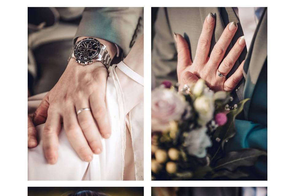 Raynaud Photo