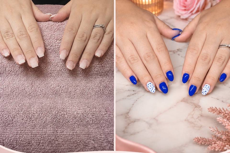 Remplissage gel