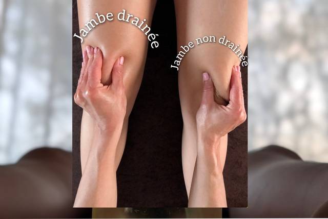 Drainage lymphatique