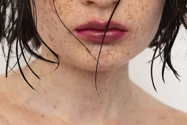 Taches de rousseurs