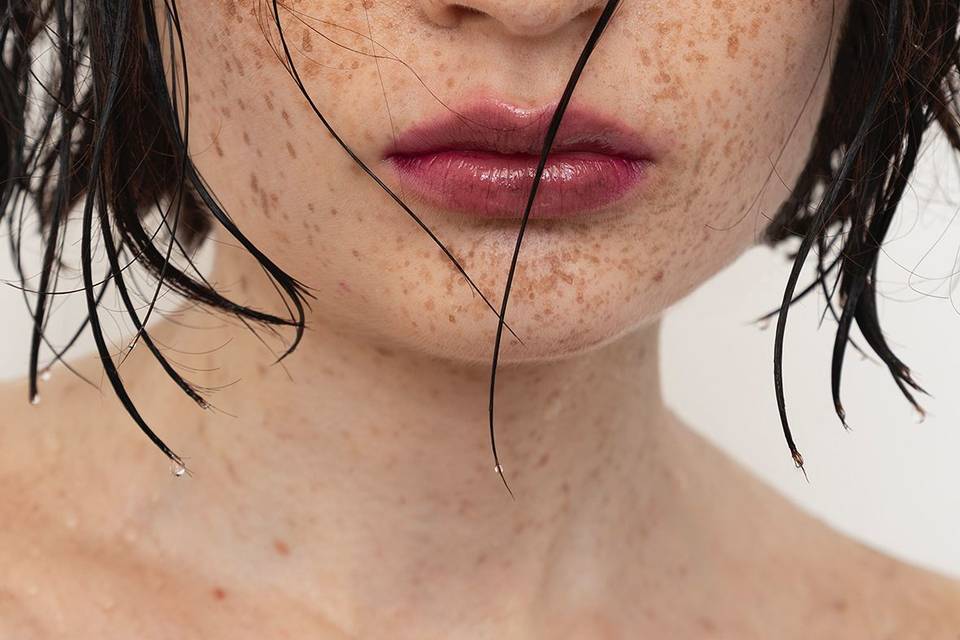 Taches de rousseurs