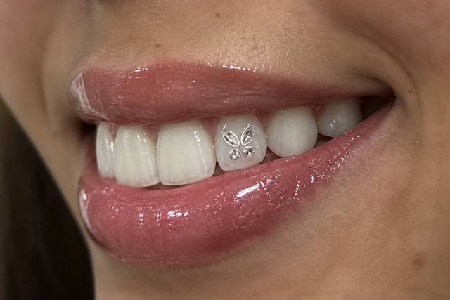 Strass dentaire Swarovski