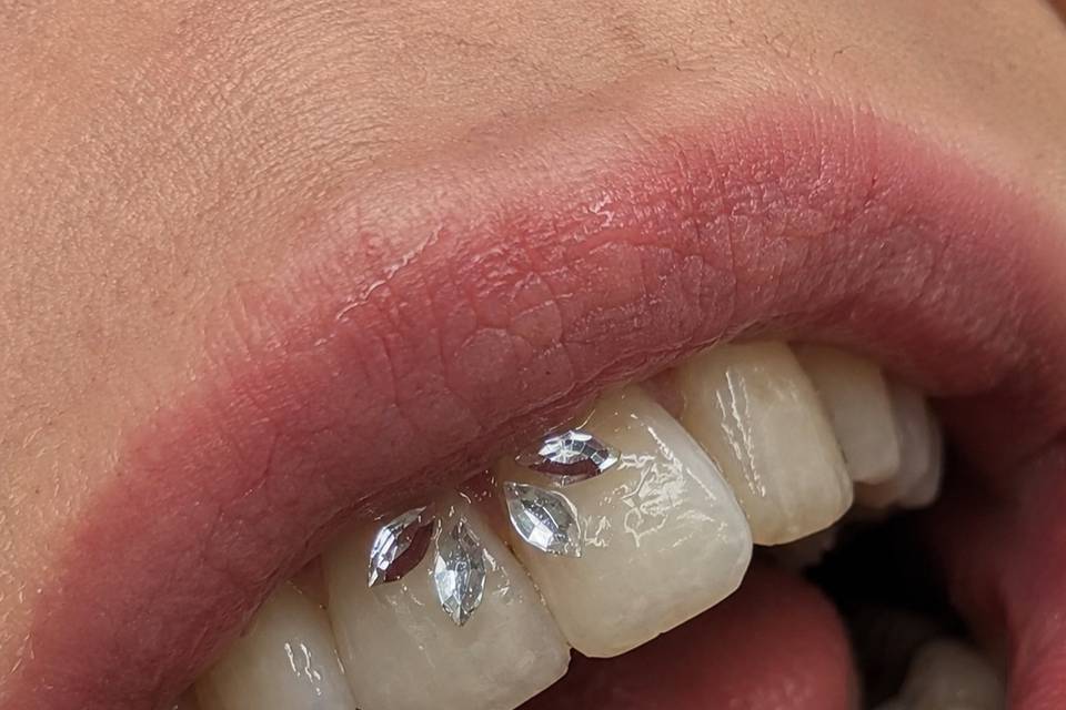 Strass dentaire Swarovski