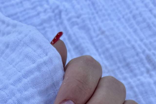 Ongles