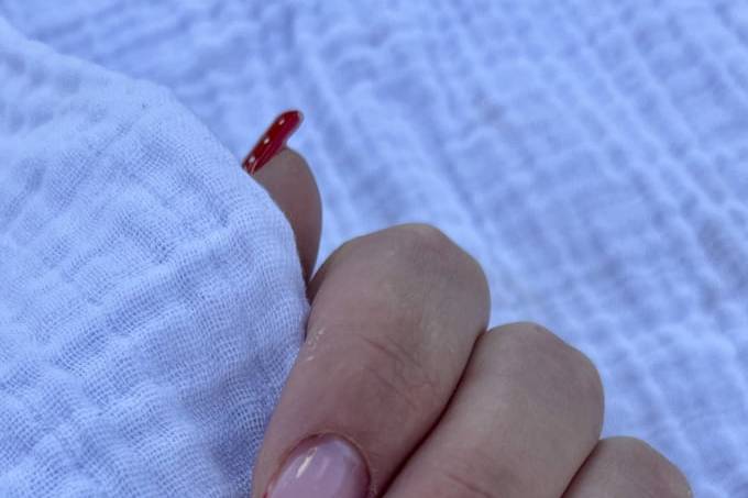 Ongles