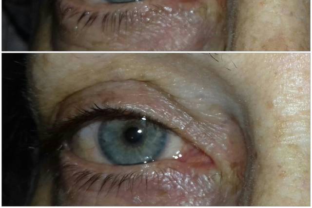 Rehaussement de cils