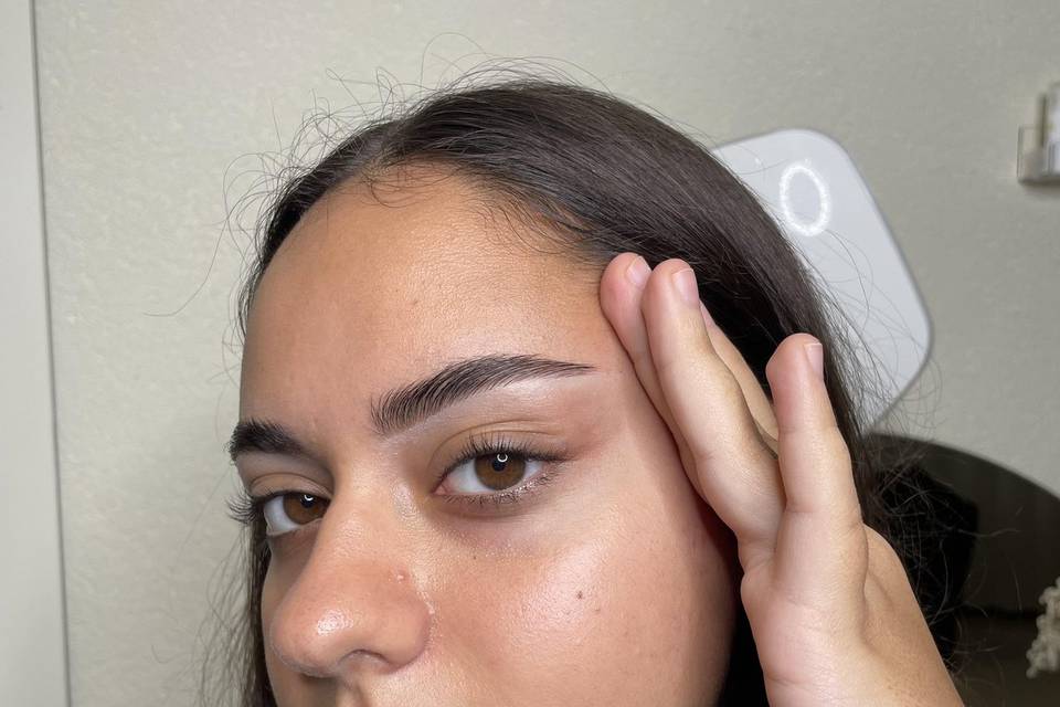 Brow lift