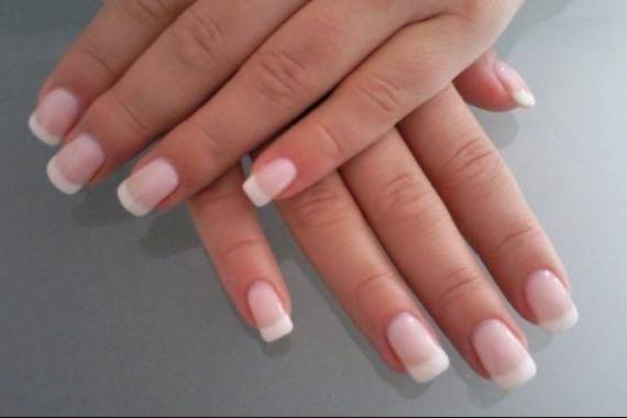 Histoire d'Ongles
