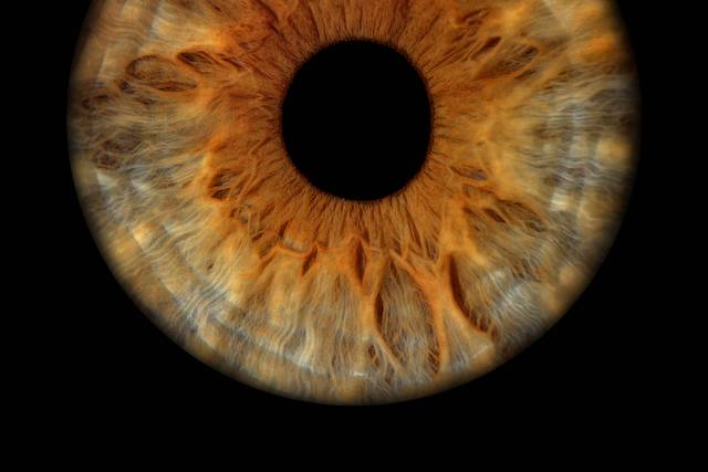 Iris Sans Effet