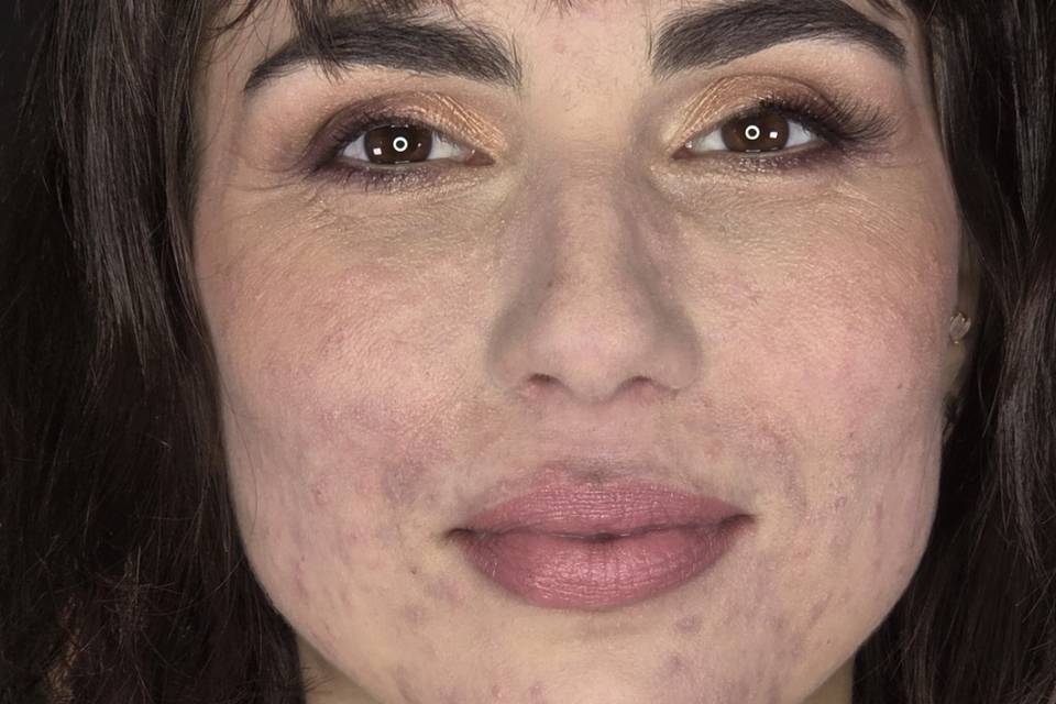 Maquillage occidental peau acn