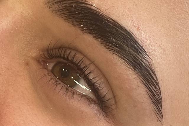Rehaussement + browlift