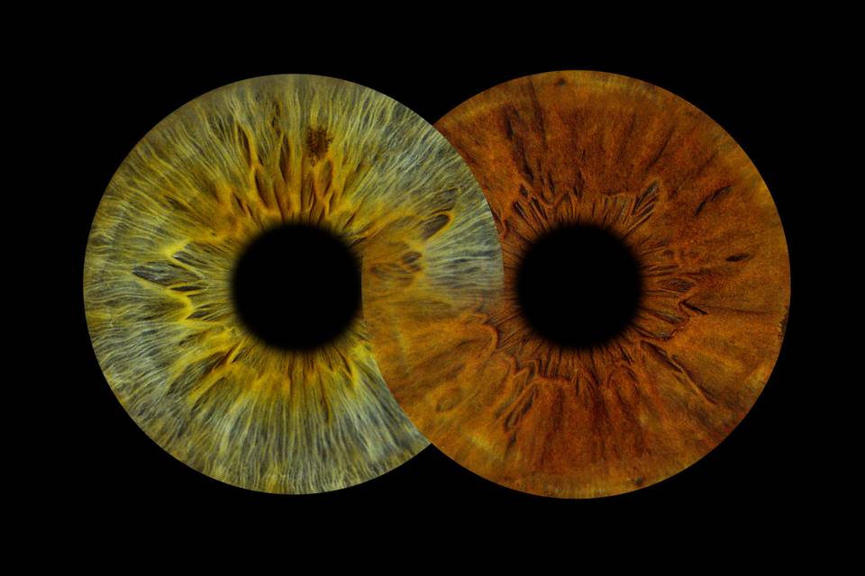 Effet infini 2 iris