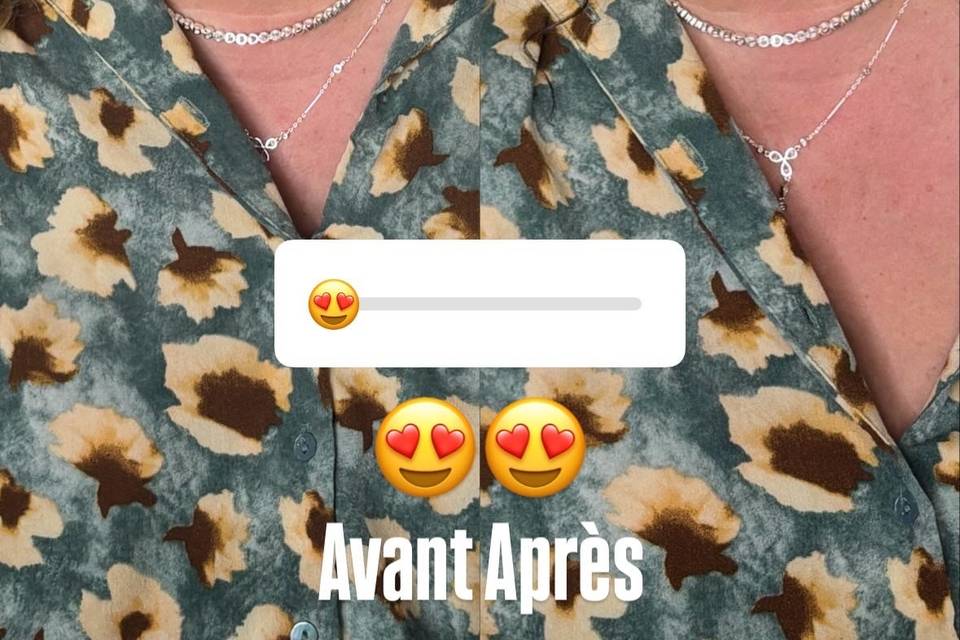 Avant apres