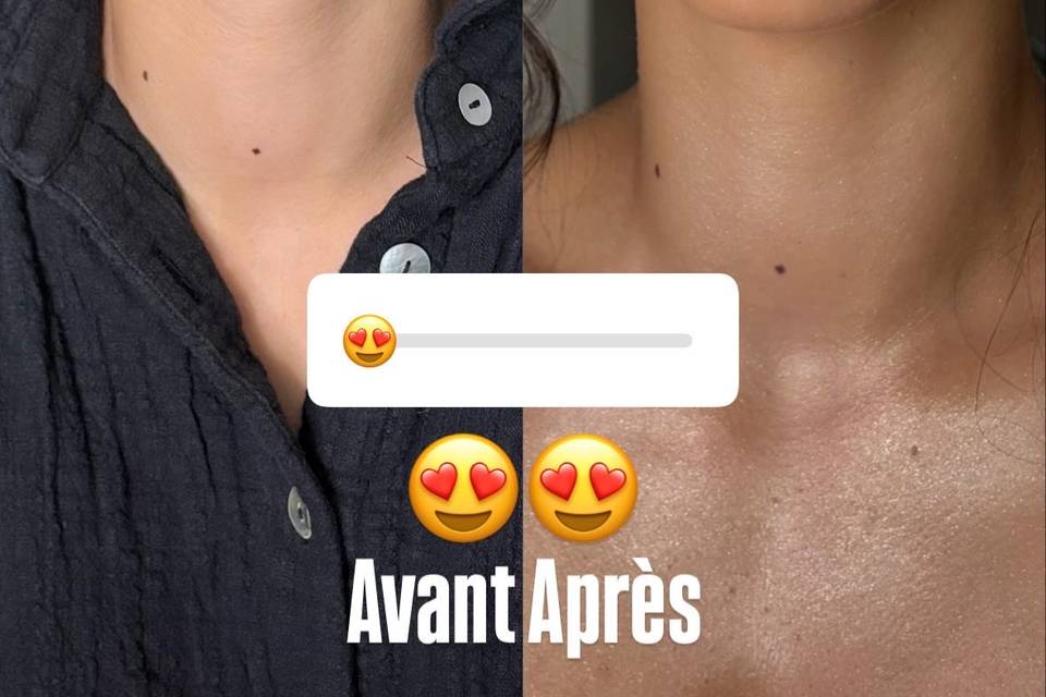 Avant apres