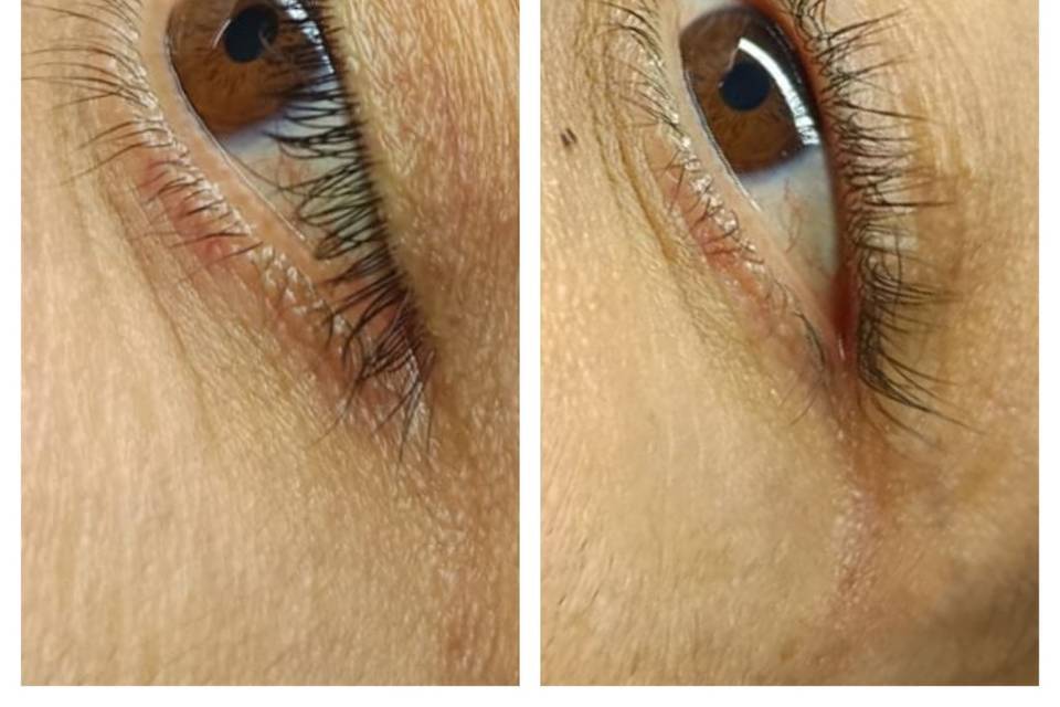 Réhaussement de cils
